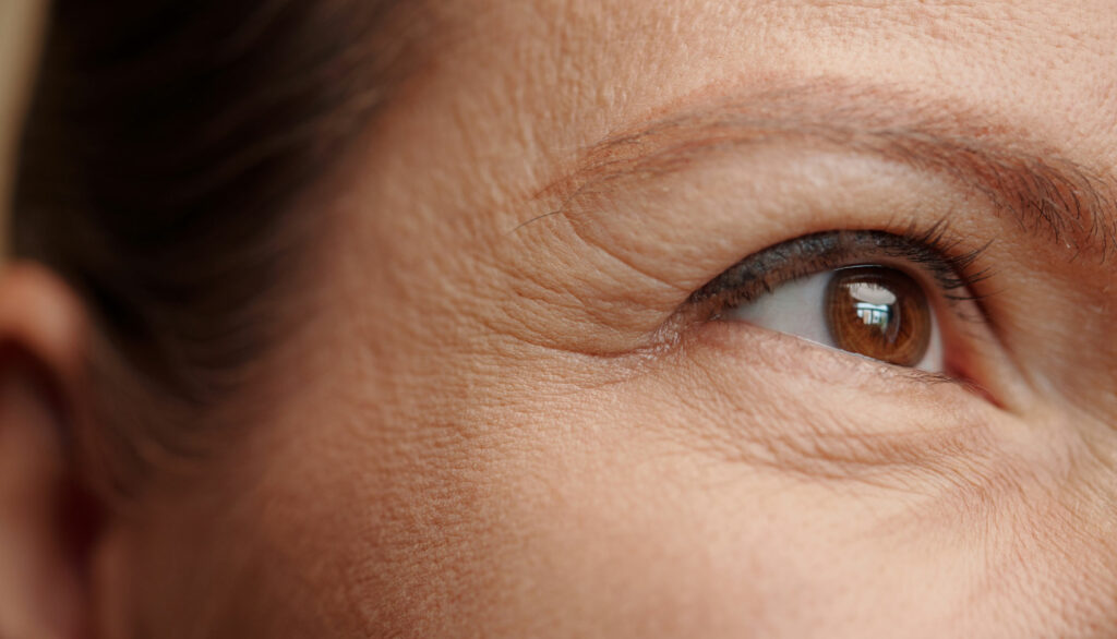 Fine Lines & Wrinkles